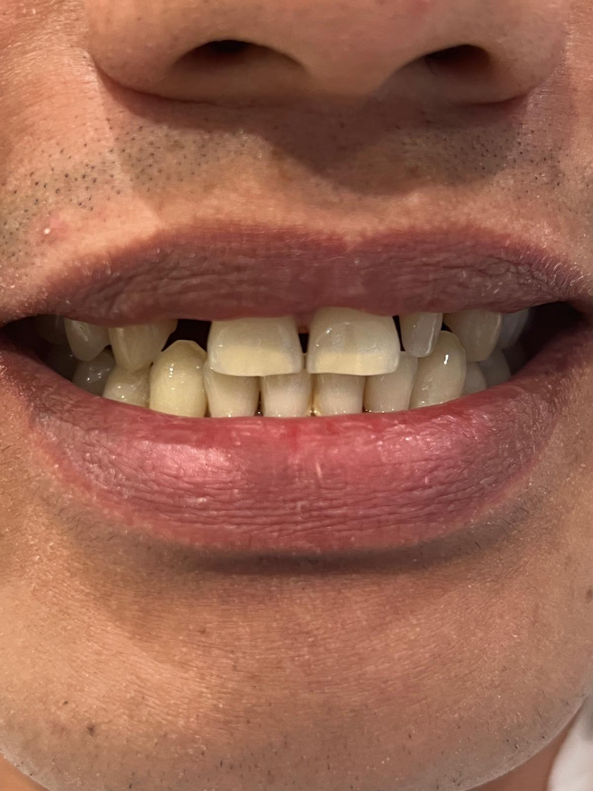 ECE Dental Patient Transformation